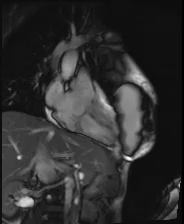 file_5e6a0a5b6493b_110_video17_MRI-RVOT2.mp4.mp4