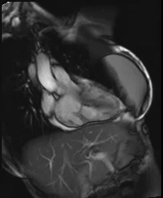 file_5e6a0a5bddfff_110_video18_MRI-RVOT3.mp4.mp4