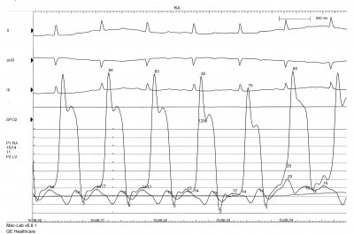 Obr. 2  (A) 