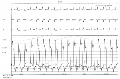 Obr. 2  (B) 