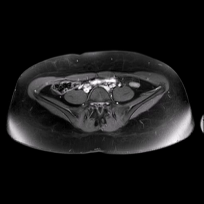 file_603e4fd633785_140_Video_3_MRI_flebografie.mp4.mp4