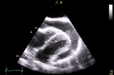 file_61851c18d9246_151_Kazuistika_Brabec_video_1.mp4.mp4