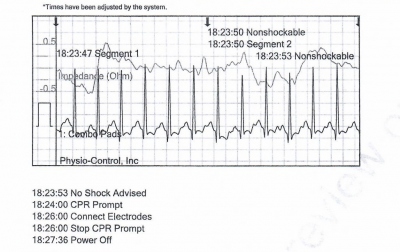 Obr. 3  Zznam z AED, tet analza rytmu, nedefibrilovateln rytmus