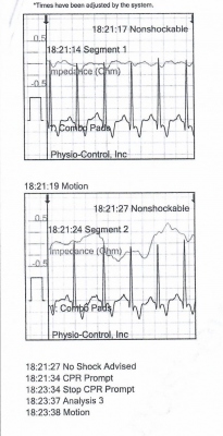 Obr. 2  Zznam z AED, druh analza rytmu, nedefibrilovateln rytmus