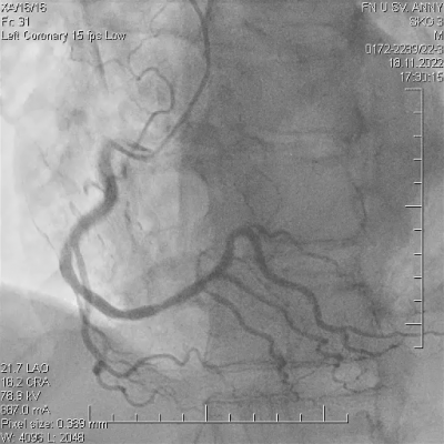 file_696886dd46d98_179_Stipalova,_Video_8,_Odezneni_spasmu_ACD.mp4.mp4